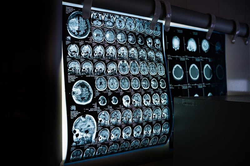 Mind-Body Awareness Scan